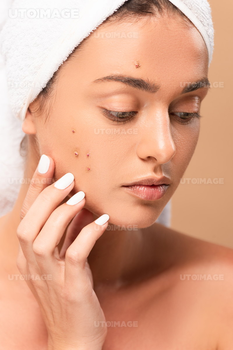 유토이미지 naked girl in towel touching face with acne isolated on beige