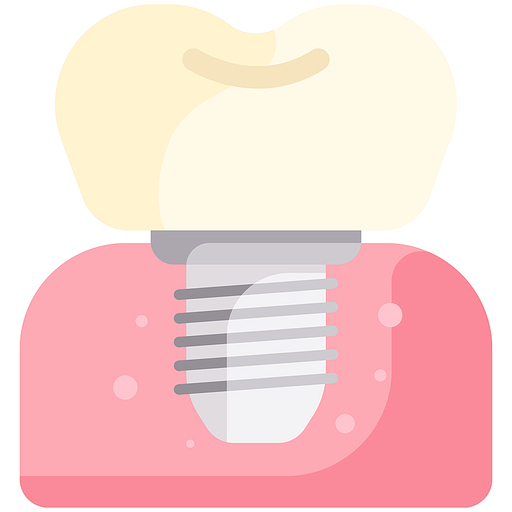 임플란트 치과 보철물 인공치아 implant teeth dental dentist