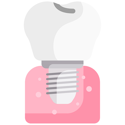 임플란트 치과 보철물 인공치아 implant teeth dental dentist