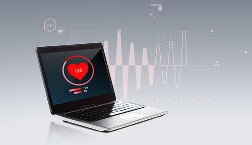 technology, health care, monitoring and cardiology concept - laptop computer with heart beat icon and cardiogram
