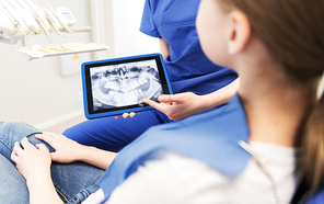 people, medicine, stomatology, technology and health care concept - close up of female dentist showing teeth x-ray on tablet pc computer screen to patient girl at dental clinic office