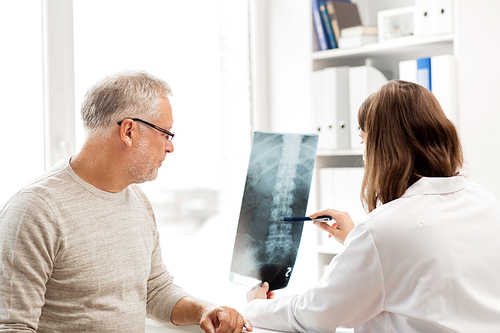 medicine, healthcare, surgery, radiology and people concept - doctor showing x-ray of spine to senior man at hospital