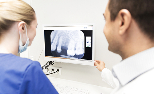 people, medicine, stomatology and health care concept - close up of dentist and assistant looking at x-ray on monitor screen at dental clinic