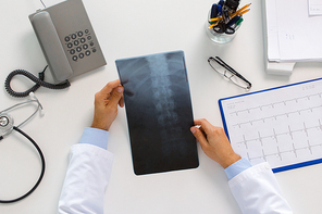 medicine, healthcare and surgery concept - hands of doctor or surgeon with spine x-ray sitting at table