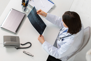 medicine, healthcare and surgery concept - doctor or surgeon with spine x-ray sitting at table