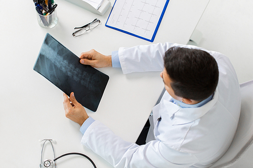 medicine, healthcare and surgery concept - doctor or surgeon with spine x-ray sitting at table