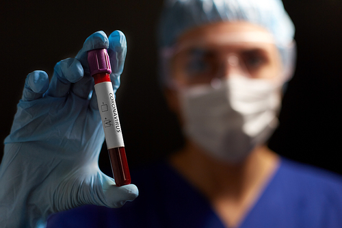 medicine, health and pandemic concept - close up of young female doctor or nurse wearing goggles, glove and face protective mask holding beaker with coronavirus blood test over black background