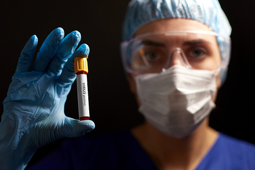 medicine, health and pandemic concept - close up of young female doctor or nurse wearing goggles, glove and face protective mask holding beaker with virus positive blood test over black background