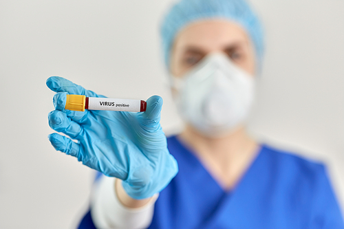 medicine, health and pandemic concept - close up of young female doctor or nurse holding beaker with virus positive blood test