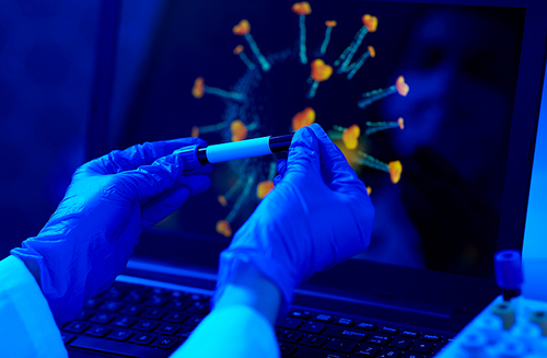 medicine, healthcare and virus concept - close up of hand in protective medical glove holding beaker with blood test over coronavirus on laptop computer screen at laboratory