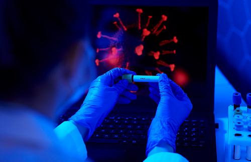 medicine, healthcare and science concept - close up of hand in protective medical glove holding beaker with virus positive blood test over coronavirus on laptop computer screen at laboratory
