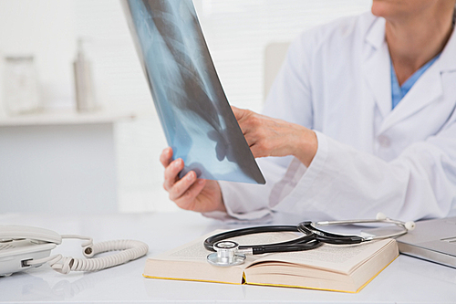 Doctor analysing xray results in medical office