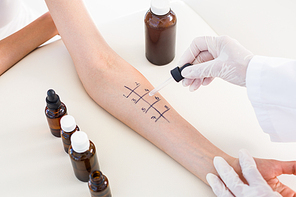 Doctor doing skin prick test at her patient in medical office