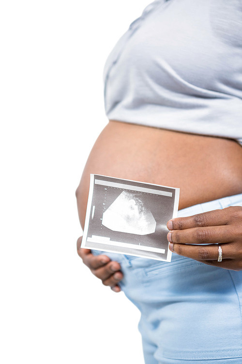 Pregnant woman holding ultrasound scan on white background