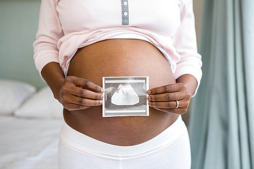 Pregnant woman holding ultrasound scan in bedroom