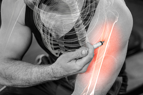 Digital composite of highlighted arm of strong man injecting anabolic steroid at gym