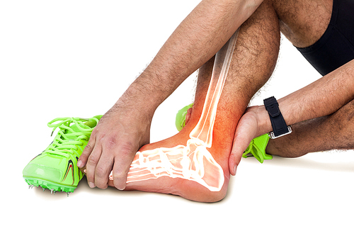 Digital composite of highlighted leg bones of injured man against white background