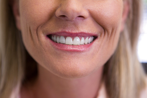 Closeup of beautiful woman smiling at dentist office
