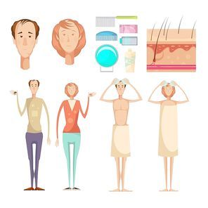 Hair loss problem isolated infographic elements set with full length male and female characters skin care vector illustration