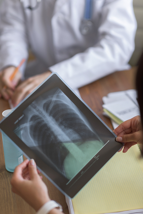 Confident practitioner consulting woman in hospital. Explaining results of chest x-ray scan