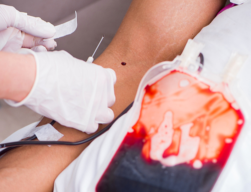 The patient getting blood transfusion in hospital clinic