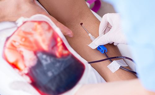 Patient getting blood transfusion in hospital clinic