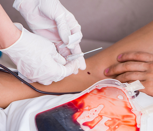 The patient getting blood transfusion in hospital clinic