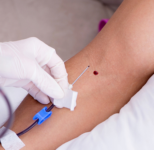 The patient getting blood transfusion in hospital clinic