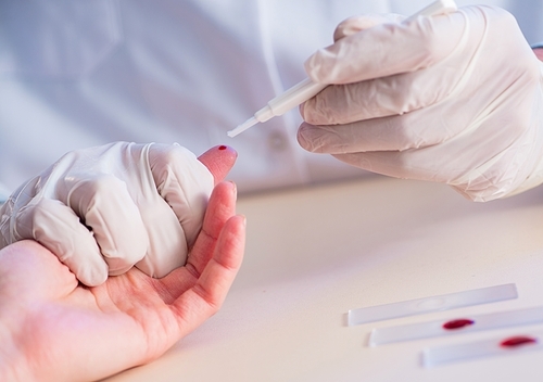 The doctor taking blood samples from finger