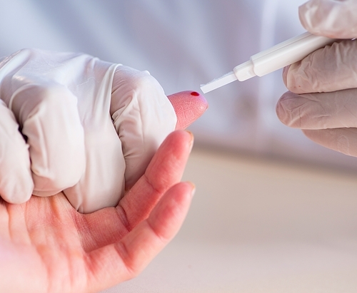 The doctor taking blood samples from finger