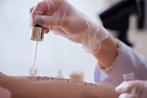 Doctor testing allergy reaction of patient in hospital