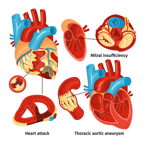 Flat icons set with heart anatomy and different types of diseases isolated on white  vector illustration