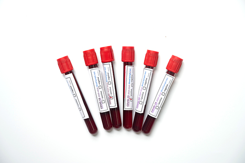 coronavirus COVID-19 sample blood test in test-tube, isolated on white