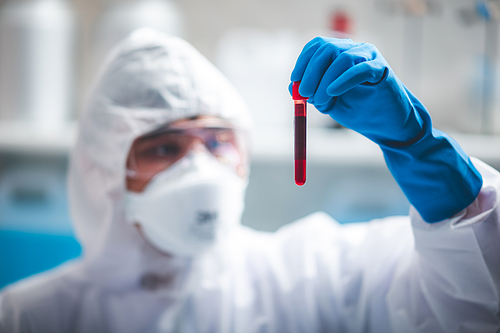 coronavirus covid-19 blood test concept, 2019-nCoV virus checking in medical laboratory with blood test tubes, researcher holding blood sample for testing in hospital lab