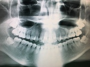 인공지능 기반의 치과 엑스레이 영상 판독 시스템