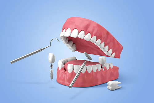 3D teeth 001