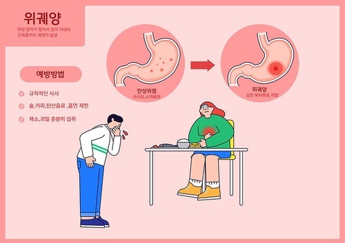 위궤양의 증상 벡터