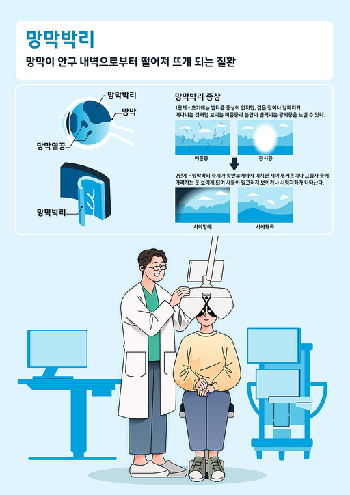 망박박리 설명과 검사