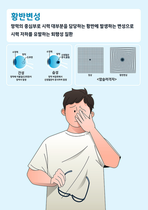 황반변성 설명과 증상