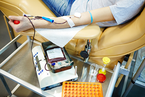 Human arm or armrest with dropper during hemotransfusion procedure