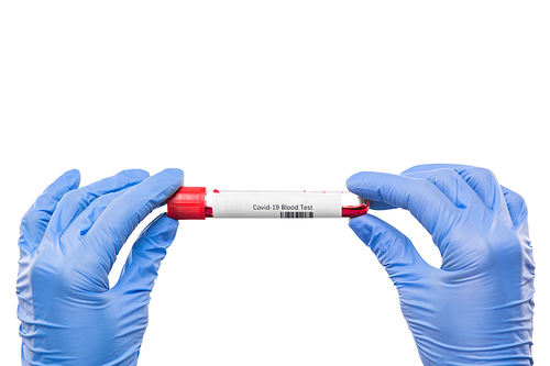Gloved hands of nurse or virologist holding flask with sample of blood for covid19 test over white background in isolation