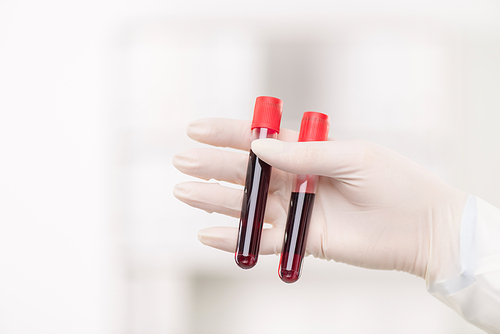 Gloved hand of contemporary female clinician holding two flasks with samples of blood during work in laboratory
