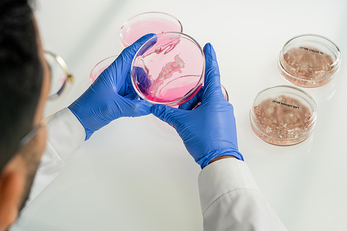Gloved hands of young male scientific researcher holding petri dish with pink liquid substance over samples of lab-grown and in-vitro meat