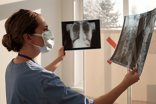 Young nurse or radiologist comparing two x-ray images of human thorax after medical examination while standing in front of window