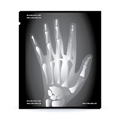 human hand x ray