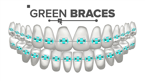 Green Child Braces Vector. Tooth And Dental Braces. Human Jaw. 3D Isolated Illustration