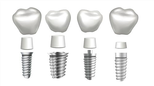 Dental Implant Set Vector. Dental Clinic Stomatology Flyer. Health Tooth Implant. Realistic Isolated Illustration