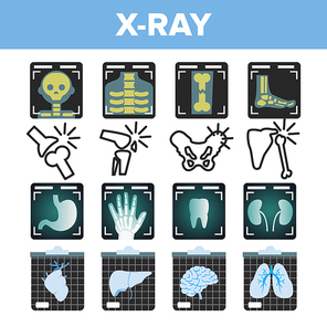 X-ray Icon Set Vector. Radiology Scan. Broken Human Bone. Medical Symbol. Fracture Structure. Health Hospital Medicine Design. Flat Illustration