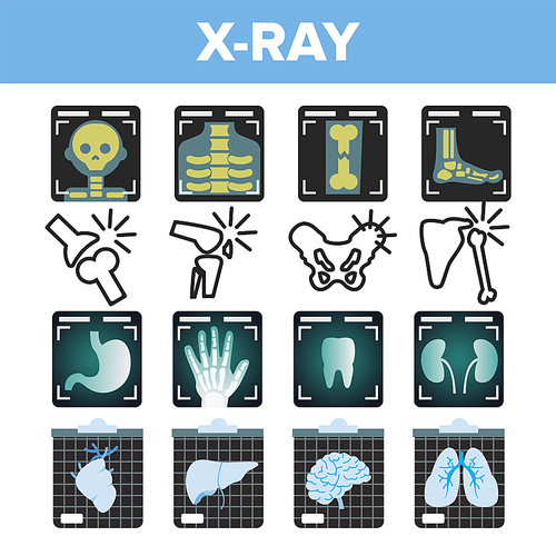 X-ray Icon Set Vector. Radiology Scan. Broken Human Bone. Medical Symbol. Fracture Structure. Health Hospital Medicine Design. Flat Illustration