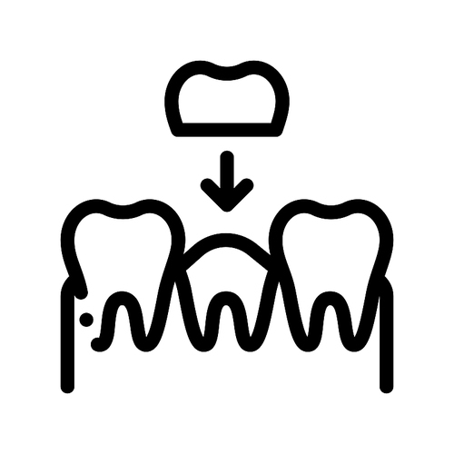 Stomatology Tooth Crown Vector Thin Line Sign Icon. Crown Dentist, Instrument Tool Equipment And Device Linear Pictogram. Medical Treatment Therapy Dentistry Monochrome Contour Illustration